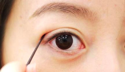 Để có được đôi mắt to tròn nhiều chị em đã không ngần ngại sử dụng các 'chiêu' làm đẹp... mạo hiểm Để có được đôi mắt to tròn nhiều chị em đã không ngần ngại sử dụng các 'chiêu' làm đẹp... mạo hiểm