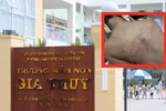 Phụ huynh tố con bị bạo hành tím lưng, Trường Mầm non Gia Thụy tạm đình chỉ giáo viên