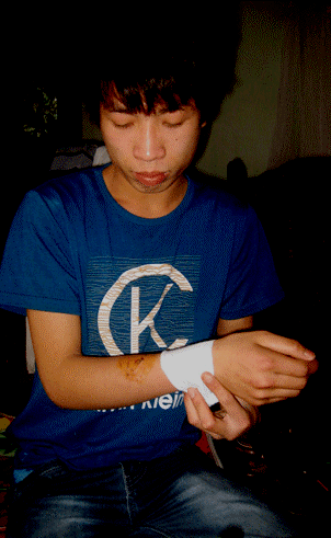 Anh Lưu Tuấn Nghĩa (Phú Mỹ - Tự Lập) bị chém ở tay (Ảnh Đ.H)