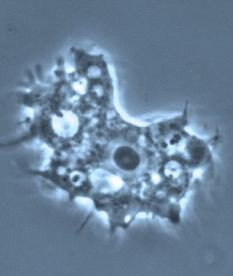 Thủ phạm: ký sinh trùng Acanthamoeba sống trong nước máy và bụi bẩn.