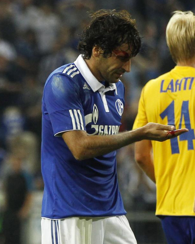 Raul đổ máu trong trận Schalke tiếp HJK Helsinki (Phần Lan) trên sân Gelsenkirchen.