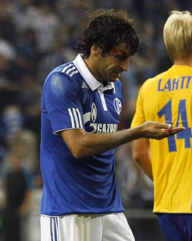 Raul đổ máu trong trận Schalke tiếp HJK Helsinki (Phần Lan) trên sân Gelsenkirchen.
