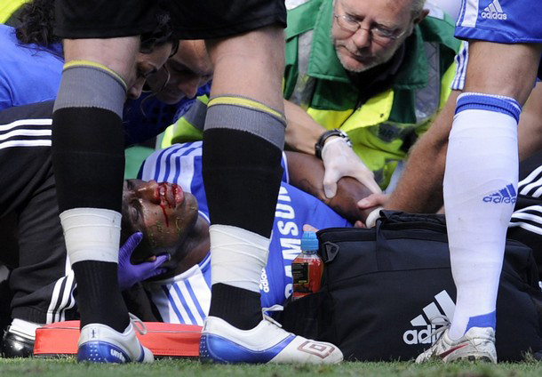 Máu đã chảy ra từ mũi và miệng của tiền đạo người Bờ Biển Ngà. Máu đã chảy ra từ mũi và miệng của tiền đạo người Bờ Biển Ngà.