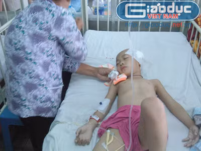 Ngã từ ban công trường trong ngày nhập học, bé lớp 1 nguy kịch