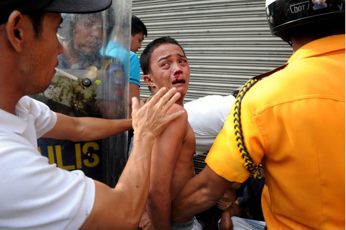 Một người đàn ông đã bị thương Một người đàn ông đã bị thương