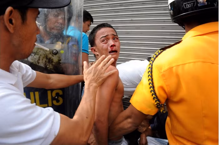 Một người đàn ông đã bị thương