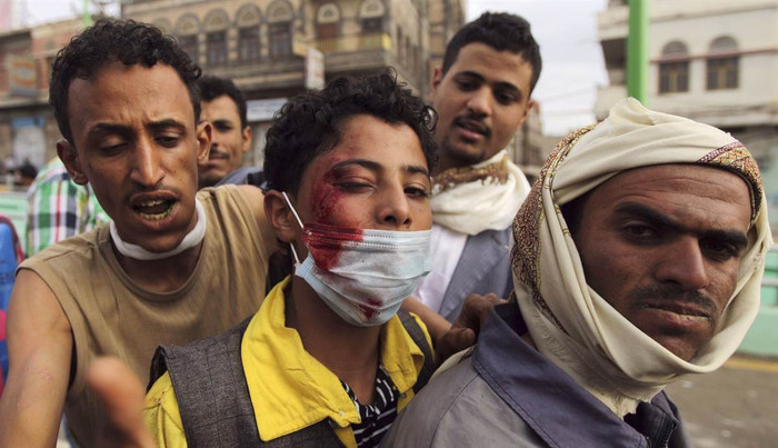 Tại Sanaa, Yemen, một người biểu tình đang bị thương saucuộc đối đầu với cảnh sát chống bạo động. Họ đã bắn súng hơi cay vào đoàn người biểu tình bên ngoài Đại sứ quán Mỹ ở thủ đô Sanaa. Tại Sanaa, Yemen, một người biểu tình đang bị thương saucuộc đối đầu với cảnh sát chống bạo động. Họ đã bắn súng hơi cay vào đoàn người biểu tình bên ngoài Đại sứ quán Mỹ ở thủ đô Sanaa.