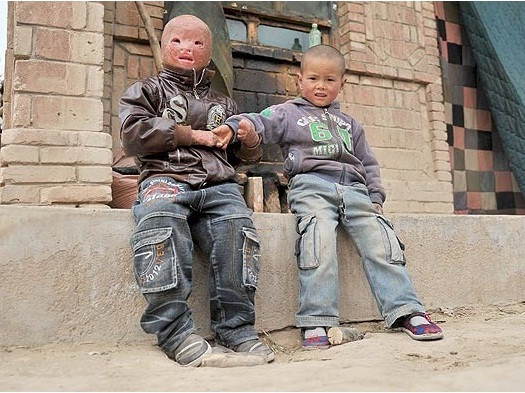 Cậu bé không đi học và chỉ có một số ít người bạn quen thuộc. Cậu bé không đi học và chỉ có một số ít người bạn quen thuộc.