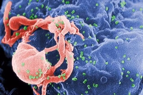 Virus HIV quan sát dưới kính hiển vi. Virus HIV quan sát dưới kính hiển vi.