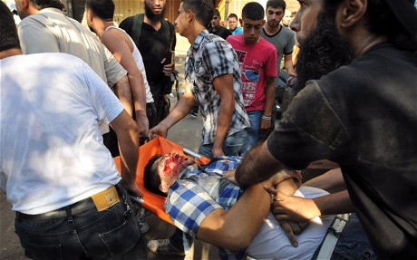 Một người bị thương trong cuộc đụng độ ở Syria. Một người bị thương trong cuộc đụng độ ở Syria.