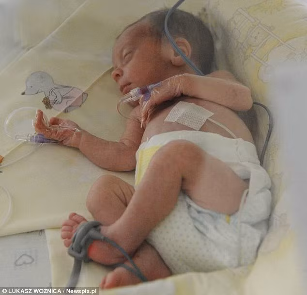 Hai bé vẫn phải nằm trong lồng kính nhưng sẽ sớm được xuất viện.