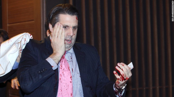 Đại sứ Mỹ Mark Lippert bị thương ở má và cổ tay trong vụ tấn công. Đại sứ Mỹ Mark Lippert bị thương ở má và cổ tay trong vụ tấn công.