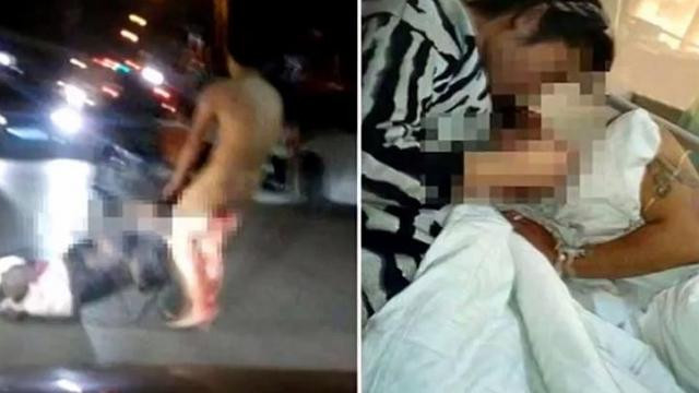 Ảnh cho thấy người chồng mình đầy máu đánh người vợ bên ngoài bệnh viện (trái) và cảnh cô vợ lẻn vào bệnh viện cắt của quý của chồng lần hai.