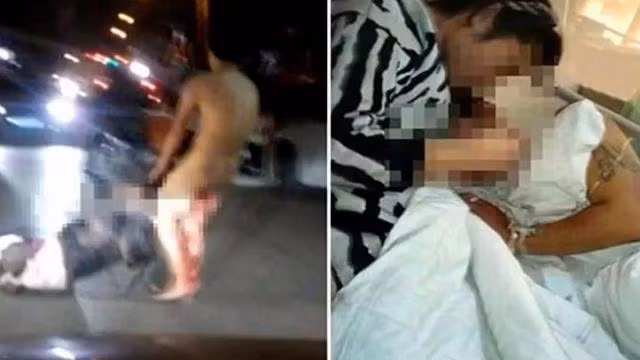 Ảnh cho thấy người chồng mình đầy máu đánh người vợ bên ngoài bệnh viện (trái) và cảnh cô vợ lẻn vào bệnh viện cắt của quý của chồng lần hai.