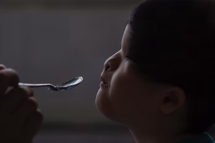 Một em bé sinh ra không có mắt do ảnh hưởng của chất độc da cam trong một cô nhi viện tại Hà Nội.