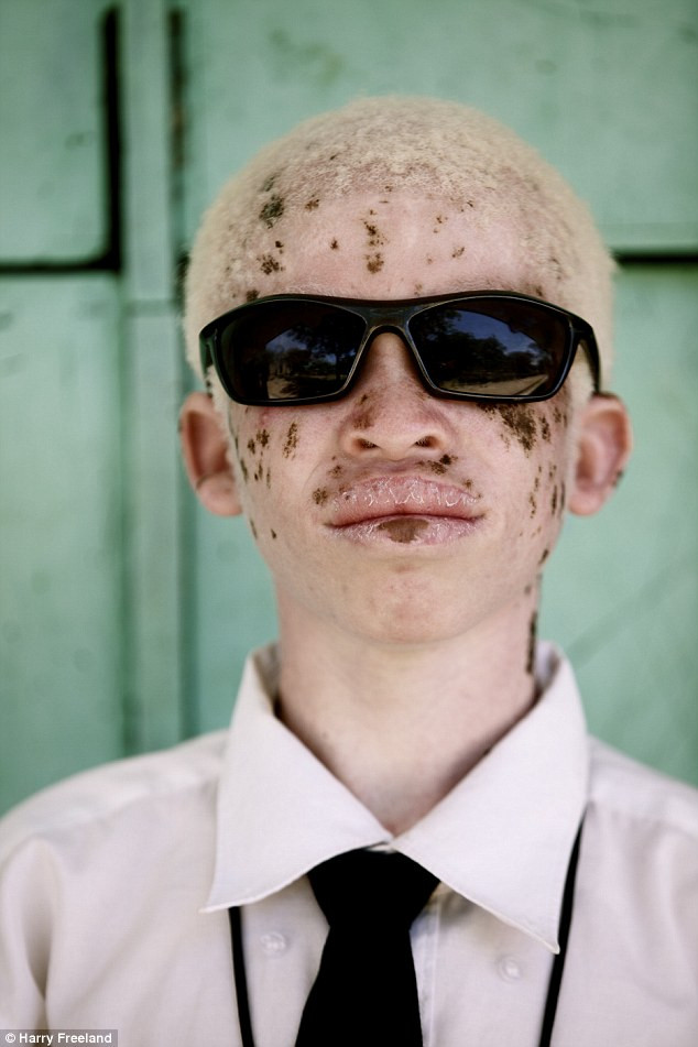 Người ta tin rằng những kẻ bỏ tiền ra mua các bộ phận cơ thể của người bạch tạng là những chính trị gia, doanh nhân giàu có. Người ta tin rằng những kẻ bỏ tiền ra mua các bộ phận cơ thể của người bạch tạng là những chính trị gia, doanh nhân giàu có.