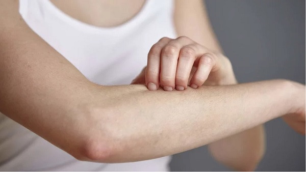 Các cách để thoát khỏi phát ban nhanh nhất (Ảnh theo Health Magazine). Các cách để thoát khỏi phát ban nhanh nhất (Ảnh theo Health Magazine).