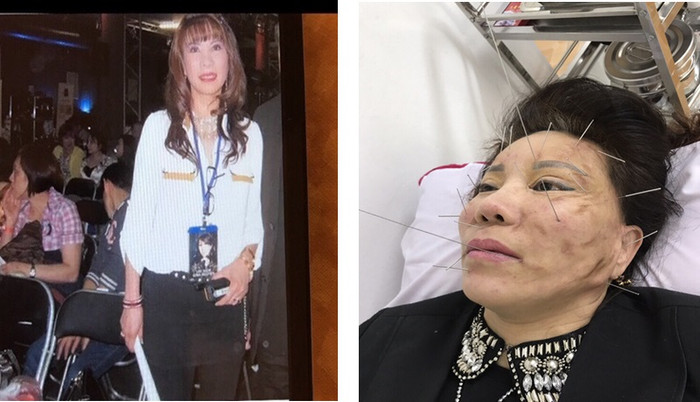 Nhiều ca thẩm mỹ không thành công. ảnh trên Pháp luật Việt Nam. Nhiều ca thẩm mỹ không thành công. ảnh trên Pháp luật Việt Nam.