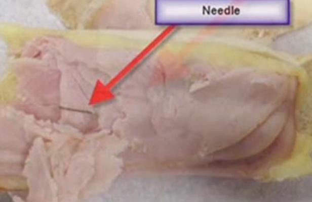 Suất ăn chứa kim khâu trên chuyến bay của Delta Airlines cách đây 2 tuần Suất ăn chứa kim khâu trên chuyến bay của Delta Airlines cách đây 2 tuần