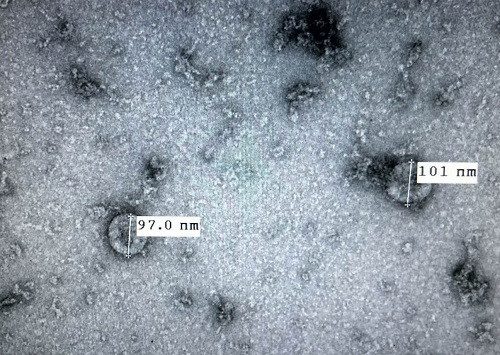 Ngày 7/2/2020, Viện Vệ sinh dịch tễ Trung ương công bố đã nuôi cấy và phân lập thành công chủng virus corona mới gây dịch viêm đường hô hấp cấp (COVID-19). Đây là tiền đề cho việc nghiên cứu và phát triển vắcxin phòng, chống loại virus này trong tương lai. (Ảnh: TTXVN )