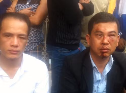 Luật sư Lê Văn Luân (trái), luật sư Trần Thu Nam (phải) là nạn nhân trong vụ hành hung hôm 3/11 (ảnh: Nhân vật cung cấp).