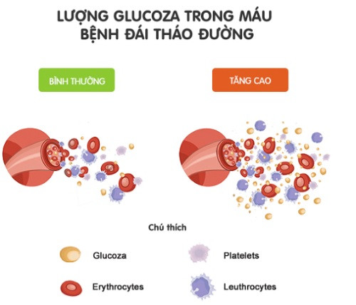 Lượng glucoza trong máu bệnh đái tháo đường.