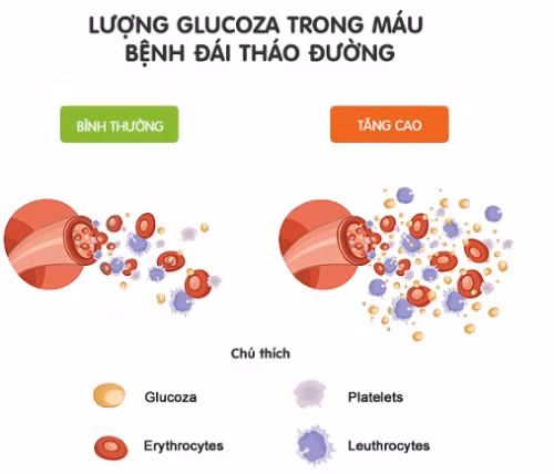 Lượng glucoza trong máu bệnh đái tháo đường.