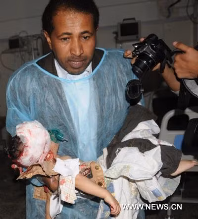 Ông lên án mạnh mẽ các hành động “lạm dụng quyền lực” của lực lượng an ninh Yemen, làm số thương vong tăng vọt trong 2 ngày qua.