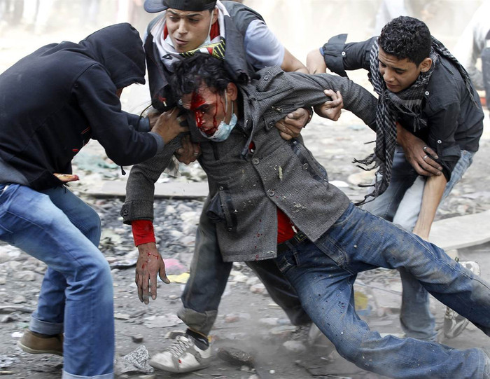 Một người biểu tình bị thương trong cuộc đụng độ với cảnh sát ở quảng trường Tahrir, Cairo, Ai Cập hôm 23/11. Một người biểu tình bị thương trong cuộc đụng độ với cảnh sát ở quảng trường Tahrir, Cairo, Ai Cập hôm 23/11.