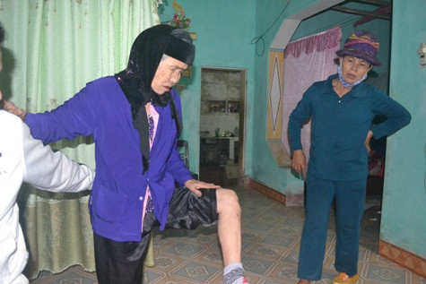 Bà ngoại anh Trường cũng bị nhóm côn đồ hành hung dẫn đến chấn thương