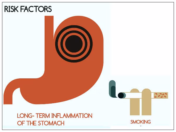 Hút thuốc lá gây hại cho hệ thống tiêu hóa(Ảnh: theo boldsky).