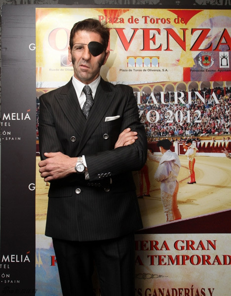 Tai nạn khiến khuôn mặt của Juan Jose Padilla cũng bị biến dạng.