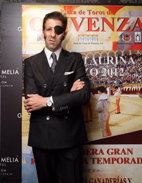 Tai nạn khiến khuôn mặt của Juan Jose Padilla cũng bị biến dạng.