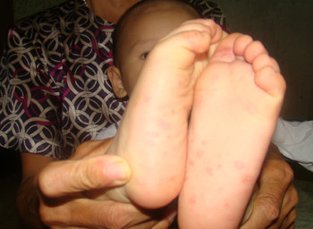 Một trong những trường hợp "cầu cứu" TS.Khải Một trong những trường hợp "cầu cứu" TS.Khải