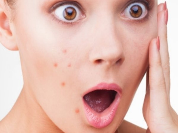 Làm thế nào để sử dụng dầu mè trong điều trị mụn trứng cá? ảnh 2