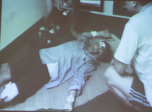 Kiểm ngư bị thương do tàu Trung Quốc phun nước làm vỡ kính. Kiểm ngư bị thương do tàu Trung Quốc phun nước làm vỡ kính.