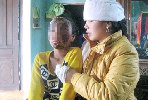 Vụ nổ đài khiến anh Tỉnh thiệt mạng, vợ và con nạn nhân cũng bị thương nặng Vụ nổ đài khiến anh Tỉnh thiệt mạng, vợ và con nạn nhân cũng bị thương nặng