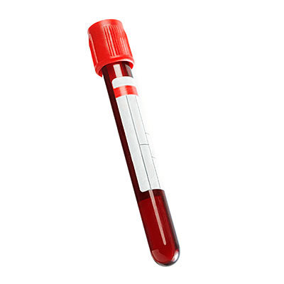 Tiến hành các phương pháp kiểm tra an toàn trước khi quyết định mang thai Tiến hành các phương pháp kiểm tra an toàn trước khi quyết định mang thai