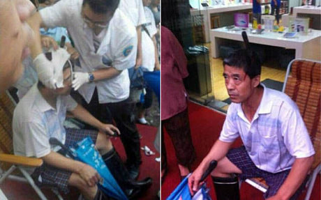 Ông Xiao và con dao trên đầu chờ xe cấp cứu. Ông Xiao và con dao trên đầu chờ xe cấp cứu.