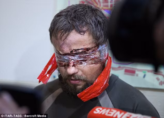 Một thành viên Alpha bị bịt mắt bằng băng dính có vết máu khô.