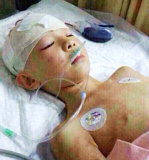 Li Li rơi vào trạng thái hôn mê sau khi bị cô giáo đánh. Li Li rơi vào trạng thái hôn mê sau khi bị cô giáo đánh.