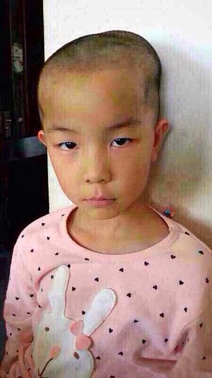 Li Li với phần đầu bị tổn thương không còn muốn đến trường. Li Li với phần đầu bị tổn thương không còn muốn đến trường.