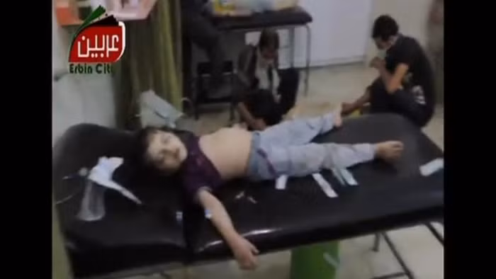 Một em bé bị ngộ độc khí sarin.