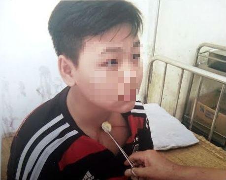 Thầy giáo túm cổ, tát tai, đạp vào người học sinh mong có cơ hội làm lại từ đầu ảnh 2 Thầy giáo túm cổ, tát tai, đạp vào người học sinh mong có cơ hội làm lại từ đầu ảnh 2