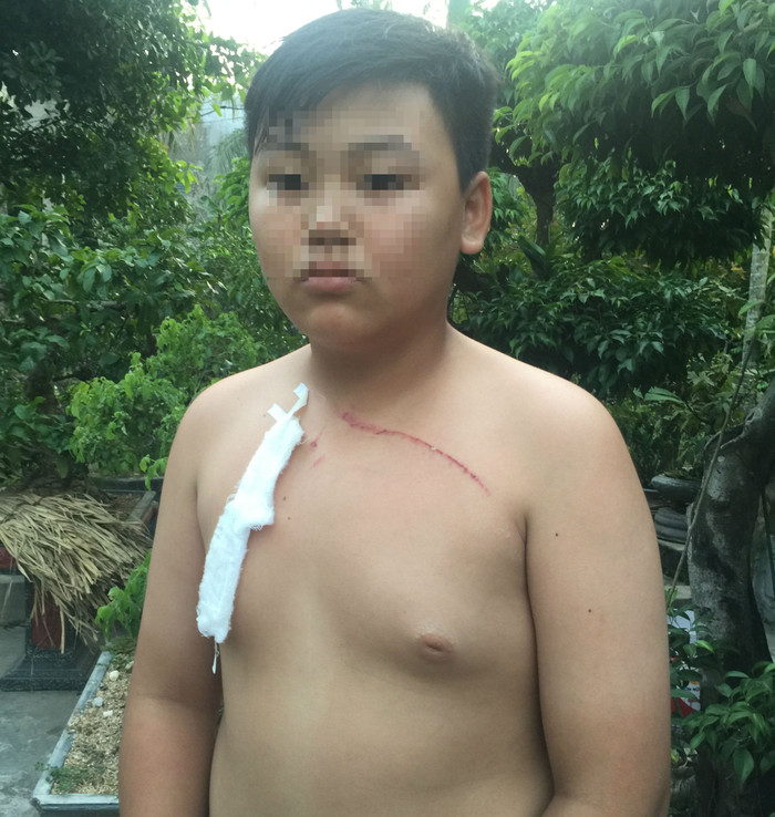 Em Hoàng N.T., học sinh lớp 8A trường THCS Quảng Đông bị thầy giáo hành hung (ảnh: XUÂN DU). Em Hoàng N.T., học sinh lớp 8A trường THCS Quảng Đông bị thầy giáo hành hung (ảnh: XUÂN DU).