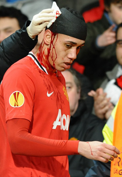 Chris Smalling có thể thi đấu từ tuần sau. Chris Smalling có thể thi đấu từ tuần sau.