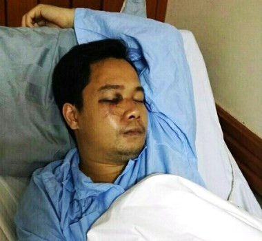 Anh Trần Hoài Nam, một trong những nạn nhân của vụ hành hung Anh Trần Hoài Nam, một trong những nạn nhân của vụ hành hung