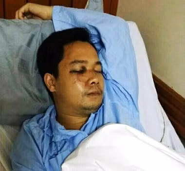 Anh Trần Hoài Nam, một trong những nạn nhân của vụ hành hung