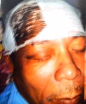 Ông Lê Văn Toàn - trưởng phố kiều đại 1 bị đánh đến chấn động não