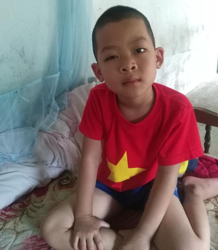 Mắt phải của cháu Đàm Công M. nghi bị cô giáo đánh hiện vẫn còn đau nhức và chỉ nhìn được khoảng 1 mét. Ảnh: BĐ Mắt phải của cháu Đàm Công M. nghi bị cô giáo đánh hiện vẫn còn đau nhức và chỉ nhìn được khoảng 1 mét. Ảnh: BĐ